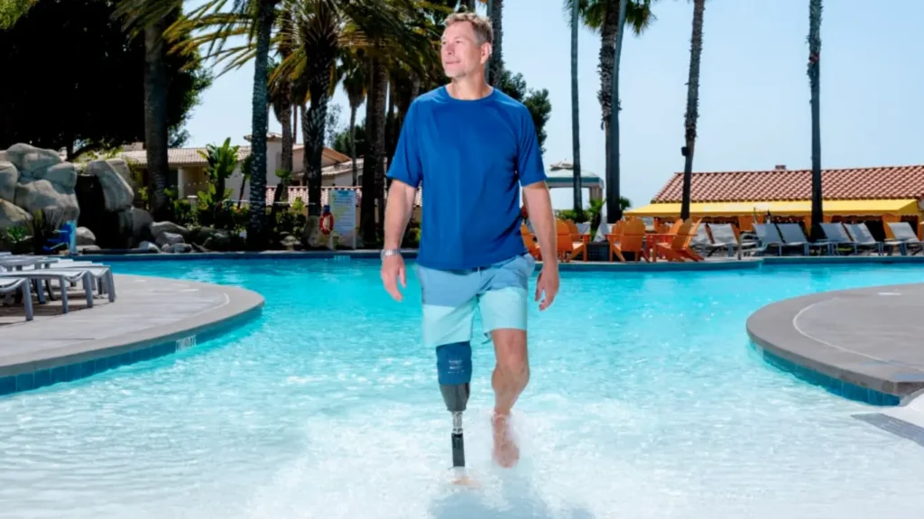 Unterschenkel-prothese-muelheim-sanitaetshaus